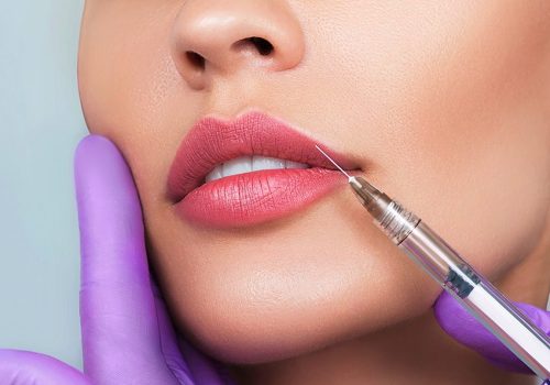 Aumento de labios con inyeccion con acido hialuronico